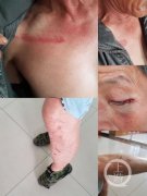 澳门太阳城赌场：六旬老父遭殴打 3月27日晚